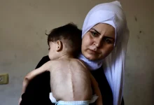 حتی کمبود نان است و کودکان از سوتغذیه رنج می‌بردند